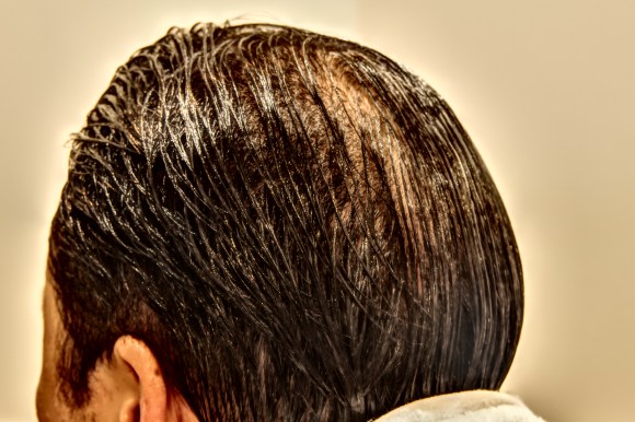 実録 60分で髪の毛が太くなる施術 ヘアライズ を 薄毛専門美容室 で試したらこうなった ロケットニュース24 実録 60分で髪の毛が太くなる施術 ヘアライズ を 薄毛専門美容室 で試したらこうなった ロケットニュース24