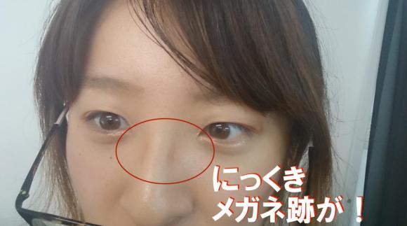 なかなか消えない メガネの鼻パッド跡 放っておくとシミになっちゃうかも 跡を残さないための対策を調べてみた Pouch ポーチ